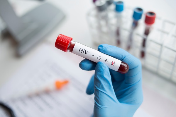 Why Routine HIV Testing Is Vital For Your Health