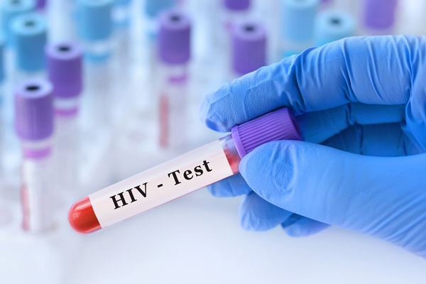 Convenient HIV Testing At Your Primary Care Office